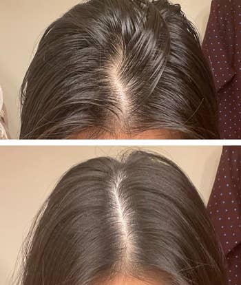 a reviewer before and after using the dry shampoo in their hair